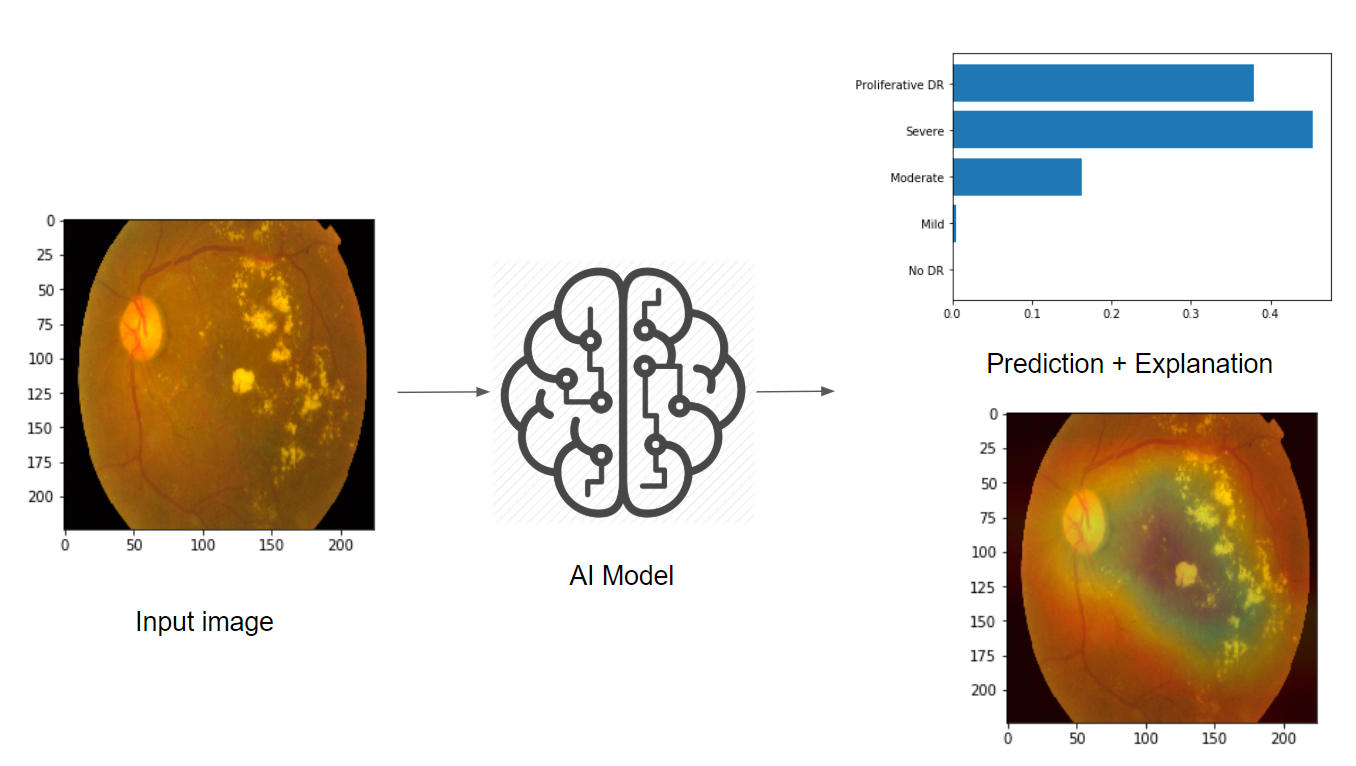 APTOS_AI_Explanation